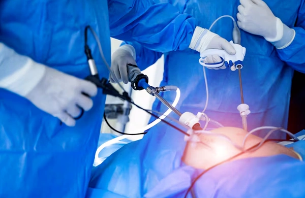 Cystoscopy