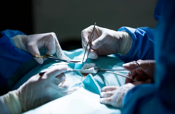 Reconstructive Surgery