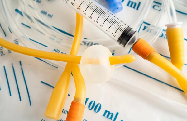 Suprapubic Catheterisation