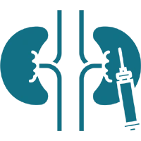 Radical Nephrectomy